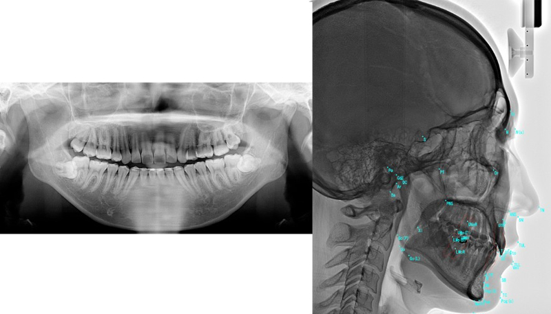 パウダールーム