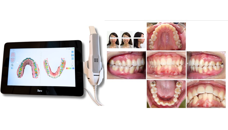 パウダールーム