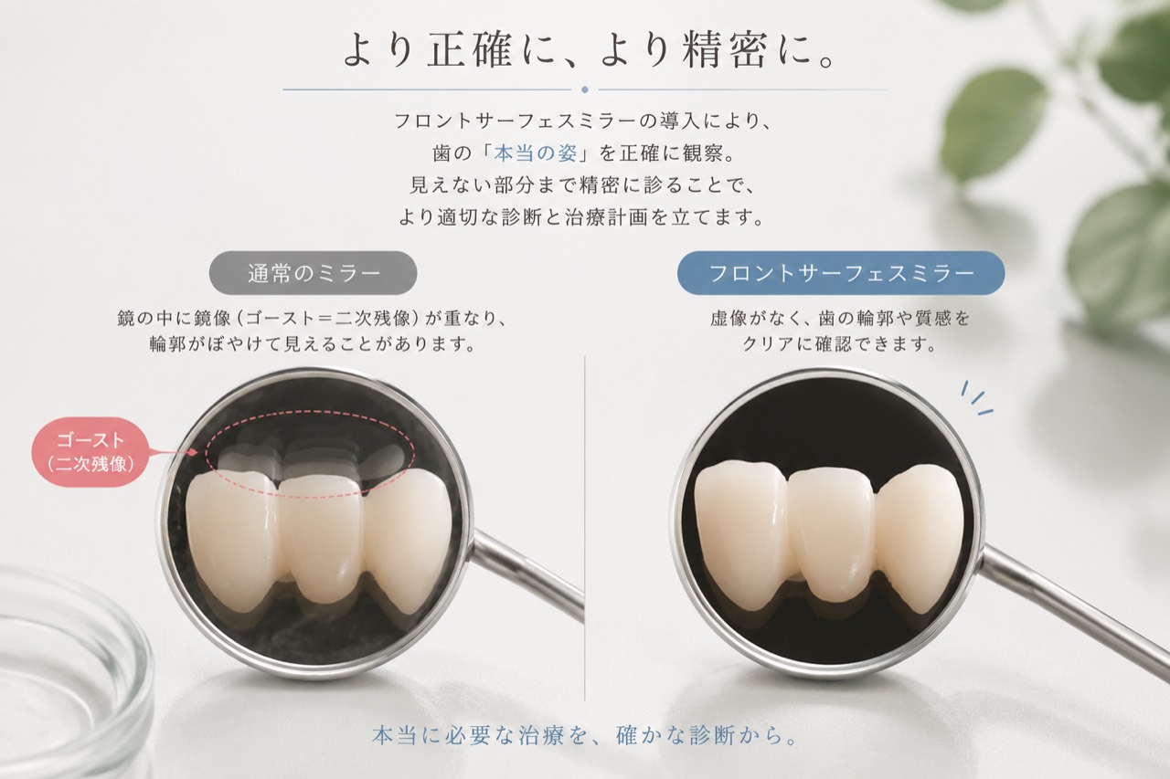 通常のミラーとフロントサーフェスミラーによる歯の見え方を比較する説明画像