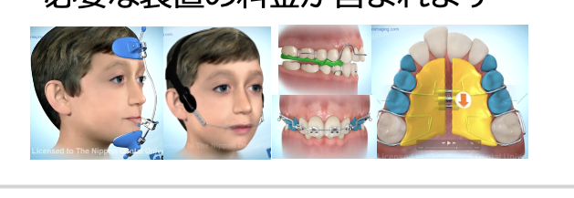 小児矯正で使用する装置の例:顎外装置、ワイヤー装置、拡大装置