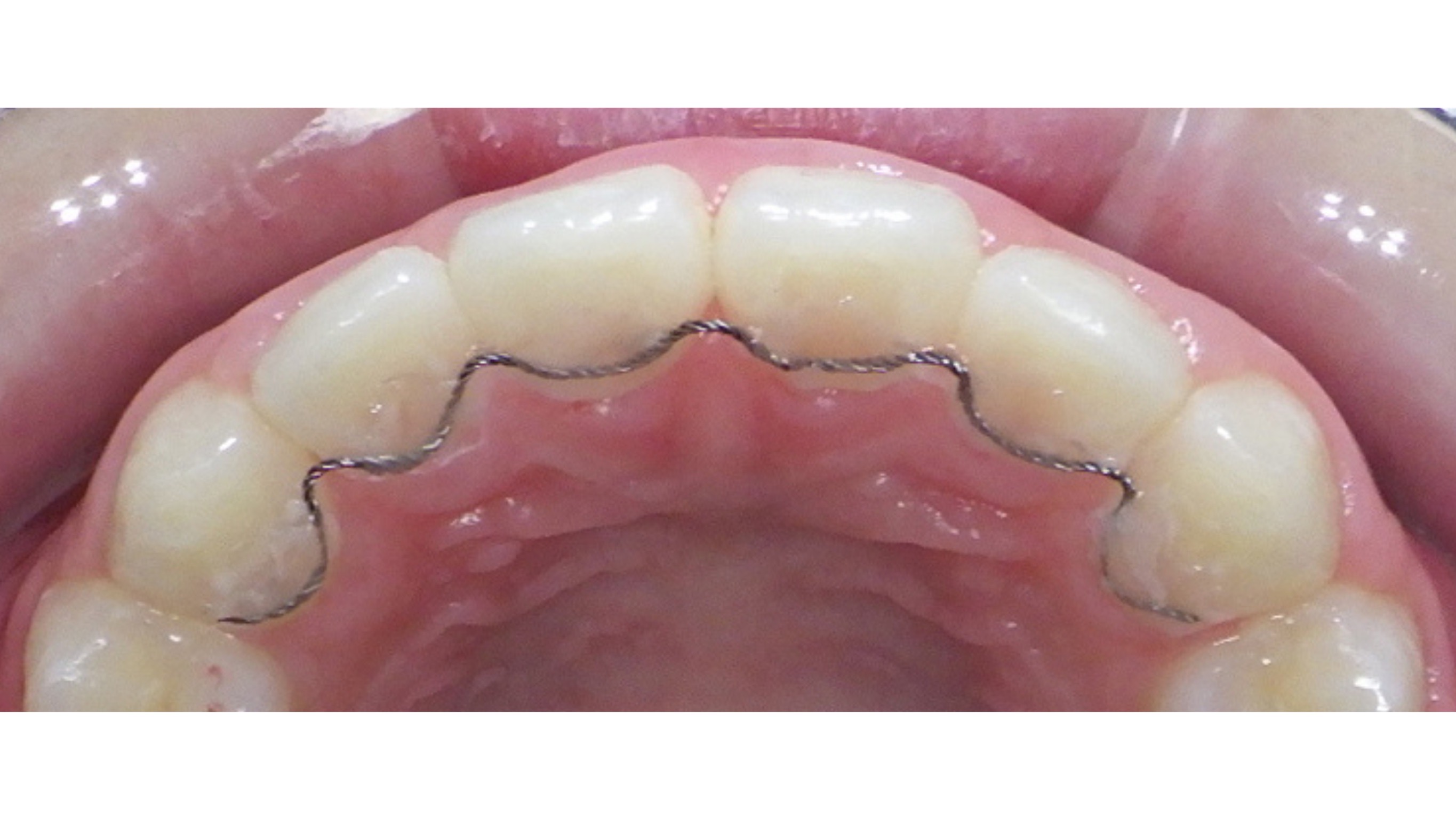 パウダールーム