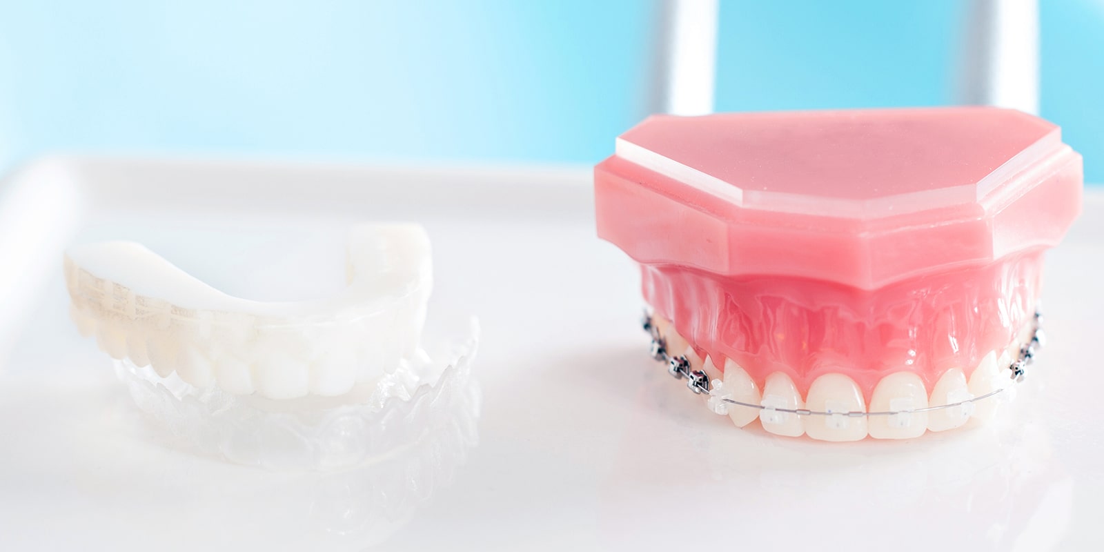 大人の矯正治療について