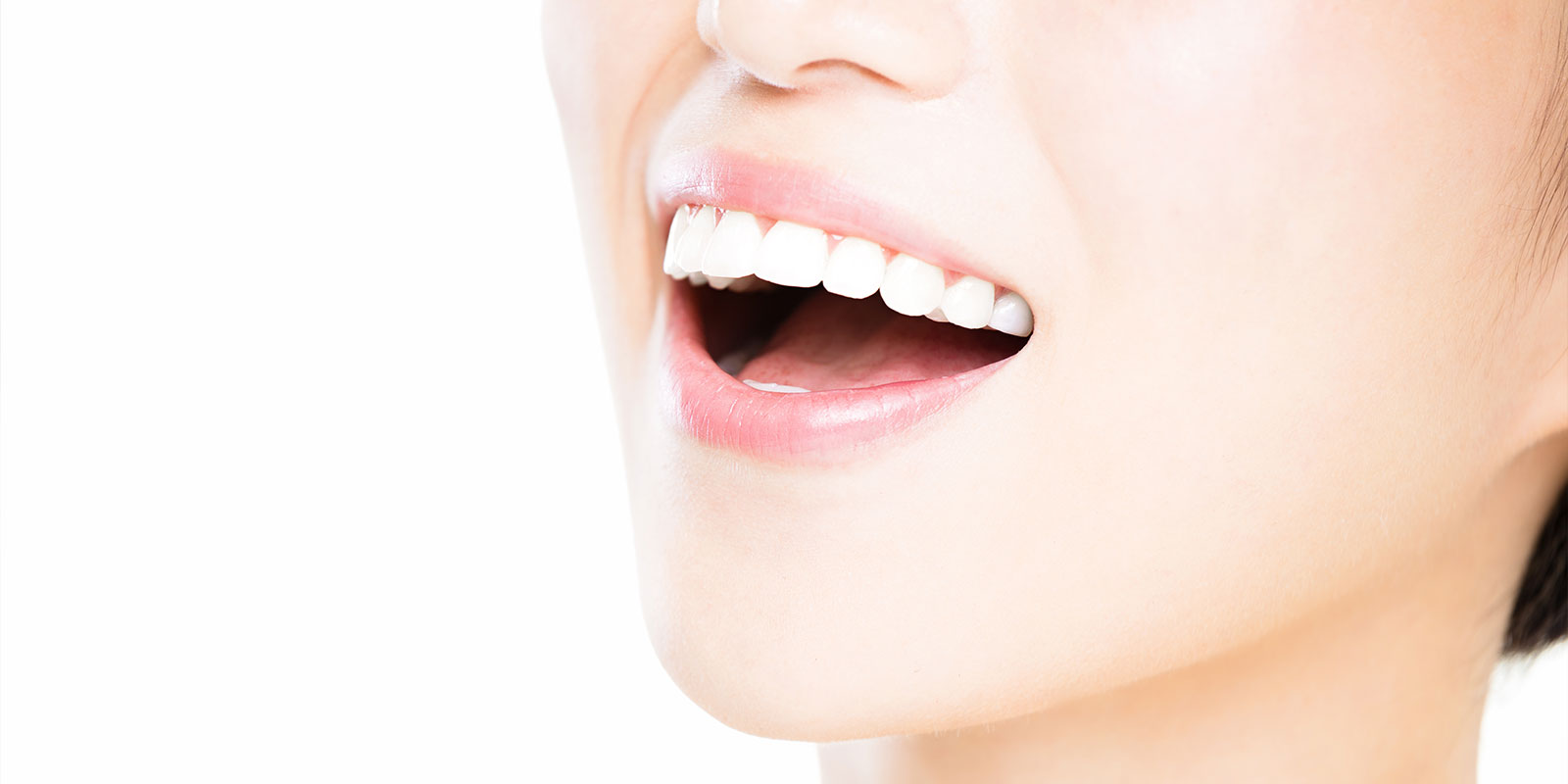 大人の矯正のメリット